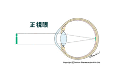 正視眼