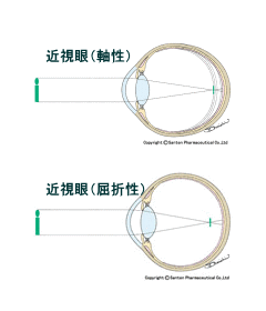 近視眼